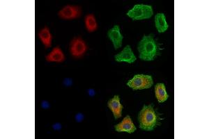 ABIN7094431 and ABIN7098479 staining Hela cells by IF/ICC.