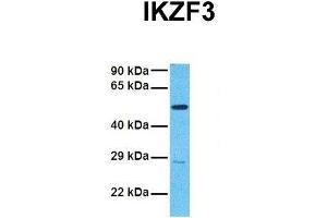 Host:  Rabbit  Target Name:  IKZF3  Sample Tissue:  Human 786-0  Antibody Dilution:  1. (IKZF3 anticorps  (N-Term))