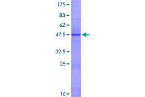 Image no. 1 for Interferon epsilon (IFNE) (AA 1-208) protein (GST tag) (ABIN1307494)