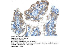 Rabbit Anti-GTPBP9 Antibody  Paraffin Embedded Tissue: Human Intestine Cellular Data: Epithelial cells of intestinal villas Antibody Concentration: 4. (OLA1 anticorps  (N-Term))