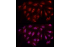 Immunofluorescence analysis of U2OS cells using WTAP Rabbit pAb (ABIN7271372) at dilution of 1:50 (40x lens).