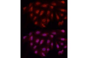 Immunofluorescence analysis of U2OS cells using WTAP Rabbit pAb (ABIN7271372) at dilution of 1:50 (40x lens). (WTAP anticorps  (AA 1-396))