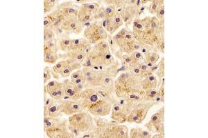 (ABIN6243301 and ABIN6578652) staining SLC29A2 in human liver tissue sections by Immunohistochemistry (IHC-P - paraformaldehyde-fixed, paraffin-embedded sections).