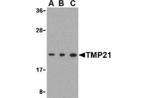 Western blot analysis of TMP21 in Raji cell lysate with this product at (A) 0.