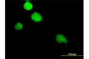 Immunofluorescence of purified MaxPab antibody to NEK2 on HeLa cell.