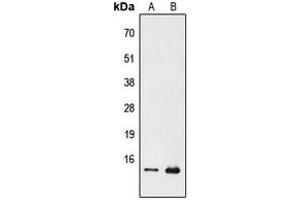 Western blot analysis of PFDN1 expression in Jurkat (A), Raw264. (PFDN1 anticorps  (N-Term))