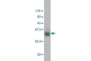 Western Blot detection against Immunogen (37. (ZNF41 anticorps  (AA 221-321))