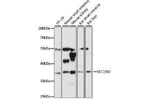 Western blot analysis of extracts of various cell lines, using SLC10A2 antibody (ABIN6292276) at 1:3000 dilution. (SLC10A2 anticorps)