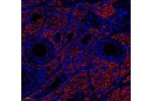 Immunofluorescence of paraffin embedded rat ovary using EMCN (ABIN7073818) at dilution of 1: 600 (180x lens)