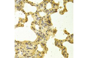 Immunohistochemistry of paraffin-embedded rat lung using TRADD antibody at dilution of 1:100 (x400 lens). (TRADD anticorps)