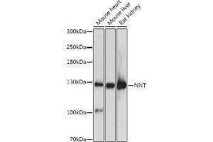 Western blot analysis of extracts of various cell lines, using NNT antibody (ABIN1681070, ABIN3019052, ABIN3019053 and ABIN6220687) at 1:3000 dilution. (NNT anticorps  (AA 881-1086))
