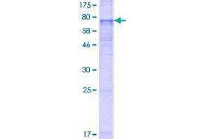 Image no. 1 for Solute Carrier Family 35, Member F3 (SLC35F3) (AA 1-421) protein (GST tag) (ABIN1320404)