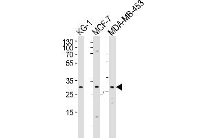 Western blot analysis of lysates from KG-1, MCF-7, MDA-MB-453 cell line (from left to right), using FOLR2 Antibody (N-term) (ABIN651222 and ABIN2840139).