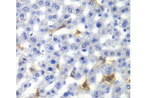 Immunohistochemistry of paraffin-embedded Rat liver using NR0B2 Polyclonal Antibody at dilution of 1:100 (40x lens). (NR0B2 anticorps)