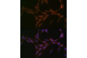 Immunofluorescence analysis of NIH-3T3 cells using 15-PGDH/HPGD Rabbit mAb (ABIN7267807) at dilution of 1:100 (40x lens).
