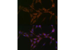 Immunofluorescence analysis of NIH-3T3 cells using 15-PGDH/HPGD Rabbit mAb (ABIN7267807) at dilution of 1:100 (40x lens). (HPGD anticorps)