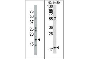 Image no. 1 for anti-Nucleoside diphosphate kinase B (NME2) (N-Term) antibody (ABIN360545) (NME2 anticorps  (N-Term))