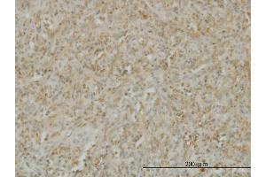 Immunoperoxidase of monoclonal antibody to TNFSF14 on formalin-fixed paraffin-embedded human spleen.