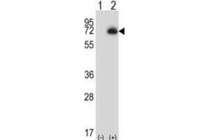 Western Blotting (WB) image for anti-Carboxypeptidase N Subunit 2 (CPN2) antibody (ABIN2997205)