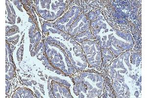 IHC analysis of Collagen VI/COL6A2 using anti-Collagen VI/COL6A2 antibody (ABIN7601439).