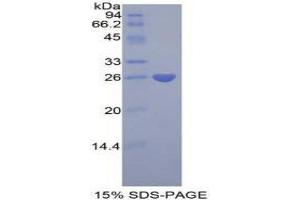 SDS-PAGE (SDS) image for Pentraxin 3 (PTX3) (AA 183-381) protein (His tag) (ABIN1877812)
