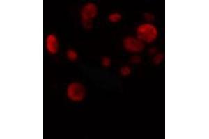 ABIN6274270 staining HuvEc cells by IF/ICC. (ETV1 anticorps  (N-Term))