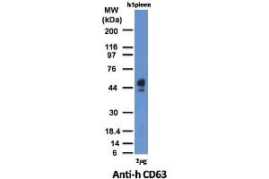 Western Blot of human Spleen lysate with CD63 Mouse Monoclonal Antibody (MX-49.