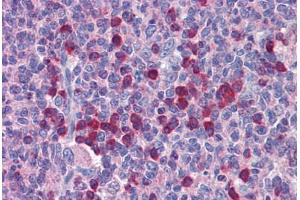 Human Tonsil: Formalin-Fixed, Paraffin-Embedded (FFPE)