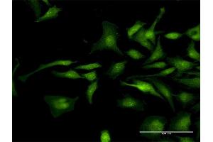 Immunofluorescence of purified MaxPab antibody to CTNND1 on HeLa cell.