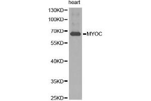 Western Blotting (WB) image for anti-Myocilin (MYOC) (AA 245-504) antibody (ABIN3022197) (MYOC anticorps  (AA 245-504))