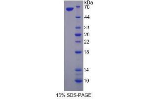 Image no. 1 for serine threonine Kinase 39 (STK39) (AA 63-545) protein (His tag) (ABIN4991023) (STK39 Protein (AA 63-545) (His tag))