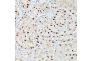 Immunohistochemistry of paraffin-embedded rat kidney using ADK Rabbit pAb  at dilution of 1:350 (40x lens).