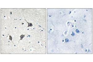 Immunohistochemistry analysis of paraffin-embedded human brain tissue using GPR20 antibody. (GPR20 anticorps  (C-Term))