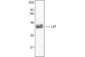 Western Blotting (WB) image for anti-Linker For Activation of T Cells (LAT) antibody (ABIN2666079) (LAT anticorps)