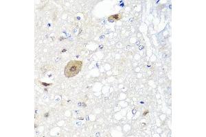 Immunohistochemistry of paraffin-embedded rat brain using FGF13 antibody at dilution of 1:100 (x40 lens). (FGF13 anticorps)