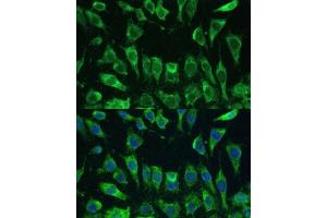 Immunofluorescence analysis of L-929 cells using Galectin 3/Galectin 3/LG antibody (ABIN6130437, ABIN6143158, ABIN6143159 and ABIN7101422) at dilution of 1:100.