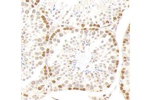 Immunohistochemistry analysis of paraffin-embedded mouse testis using,GSTT1 (ABIN7074091) at dilution of 1: 2000 (GSTT1 anticorps)