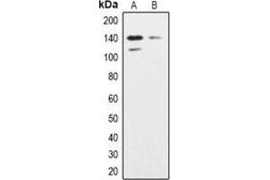 Western blot analysis of SHIP2 expression in K562 (A), Hela (B) whole cell lysates. (INPPL1 anticorps)