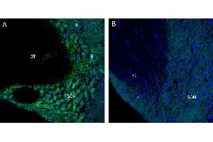 Free-floating frozen brain sections from a paraformaldehyde-perfused rat were incubated with Anti-CFTR Antibody (ABIN7043096, 1:300), followed by goat anti-rabbit secondary antibody conjugated to Alexa Fluor® 488 (green).