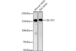 Western blot analysis of extracts of various cell lines, using TBC1D1 antibody (ABIN6129487, ABIN6148878, ABIN6148879 and ABIN6225024) at 1:1000 dilution.