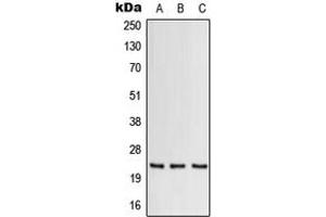 Western blot analysis of GM-CSF expression in THP1 (A), Raw264. (GM-CSF anticorps  (C-Term))