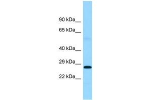 WB Suggested Anti-FTMT Antibody Titration: 1.