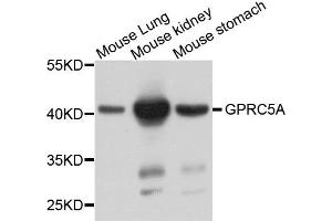 Western blot analysis of extract of various cells, using GPRC5A antibody. (GPRC5A anticorps)