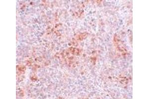 Immunohistochemistry (IHC) image for anti-Bifunctional Apoptosis Regulator (BFAR) (C-Term) antibody (ABIN1030292) (BFAR anticorps  (C-Term))