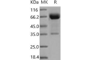 Western Blotting (WB) image for Oxidized Low Density Lipoprotein (Lectin-Like) Receptor 1 (OLR1) protein (Fc Tag) (ABIN7321159)
