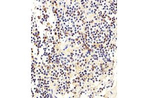 Iunohistochemical analysis of paraffin-embedded H.