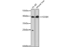 Western blot analysis of extracts of various cell lines, using HOXB4 Rabbit pAb (ABIN7267768) at 1:1000 dilution. (HOXB4 anticorps  (AA 50-150))