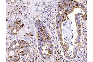 IHC analysis of Geminin/GMNN using anti-Geminin/GMNN antibody (ABIN7600598). (Geminin anticorps  (AA 21-196))