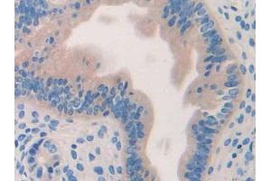 DAB staining on IHC-P; Samples: Mouse Uterus Tissue