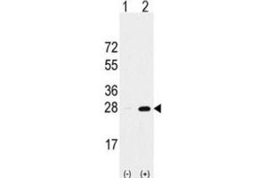Western Blotting (WB) image for anti-Proteasome Subunit alpha 5 (PSMA5) antibody (ABIN2998030) (PSMA5 anticorps)